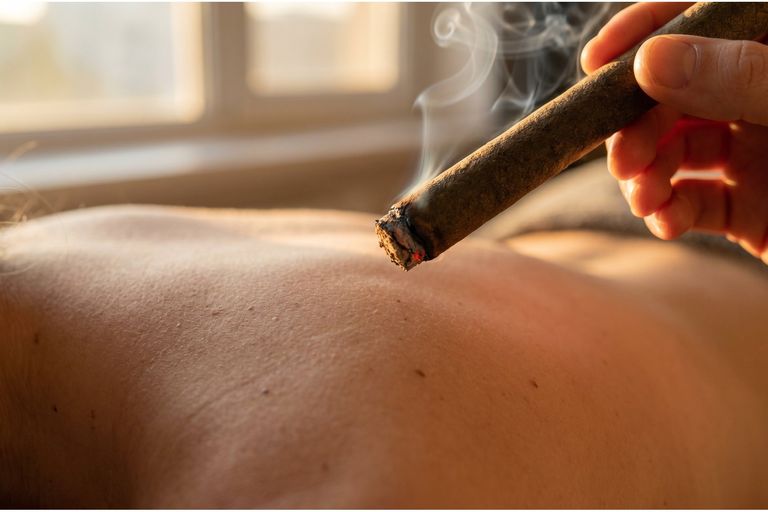 Moxibustion / Moxa